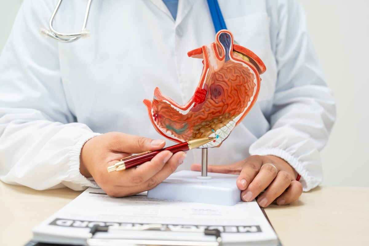 Gastrolog pokazuje model żołądka na biurku.